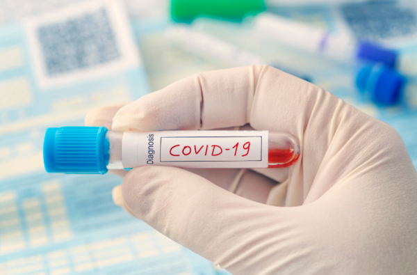 씨엘바이오가 국내 최초로 코로나19 바이러스 99.99% 살균력을 입증한 'F-120 피톤치드'에 대해 조성물 특허를 긴급출원했다. [제공=씨엘바이오]